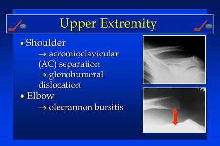  Shoulder  acromioclavicular (AC) separation  glenohumeral dislocation  Elbow  olecrannon bursitis Upper Extremity.