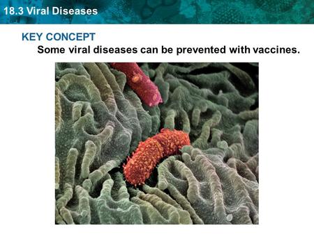 KEY CONCEPT  Some viral diseases can be prevented with vaccines.