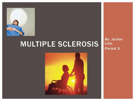 By: Jackie Lillo Period 3 MULTIPLE SCLEROSIS. INHERITANCE  Multiple Sclerosis, or MS, is an autoimmune disease that affects the central nervous system.