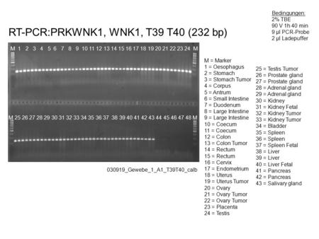 RT-PCR:PRKWNK1, WNK1, T39 T40 (232 bp) Bedingungen: 2% TBE 90 V 1h 40 min 9 µl PCR-Probe 2 µl Ladepuffer 030919_Gewebe_1_A1_T39T40_calb M 1 2 3 4 5 6 7.
