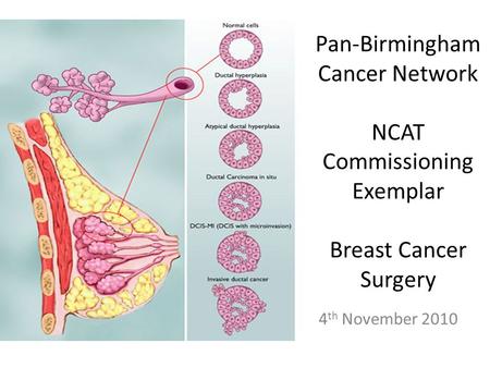 Pan-Birmingham Cancer Network NCAT Commissioning Exemplar Breast Cancer Surgery 4 th November 2010.