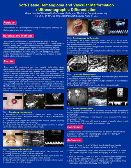 Soft-Tissue Hemangioma and Vascular Malformation : Ultrasonographic Differentiation Department of Diagnostic Radiology, College of Medicine, Dong-A University.