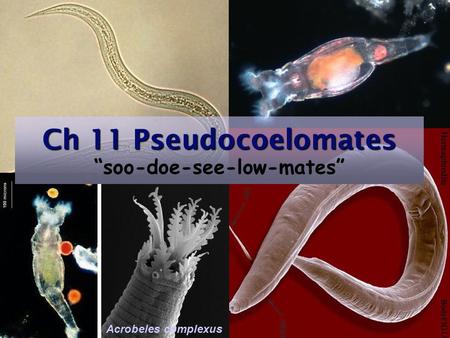 Acrobeles complexus Ch 11 Pseudocoelomates Ch 11 Pseudocoelomates “soo-doe-see-low-mates”