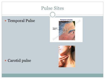 Pulse Sites Temporal Pulse Carotid pulse. Pulse Sites Brachial Pulse Radial Pulse*