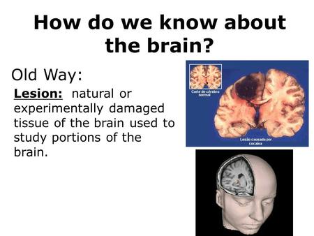 How do we know about the brain? Lesion: natural or experimentally damaged tissue of the brain used to study portions of the brain. Old Way: