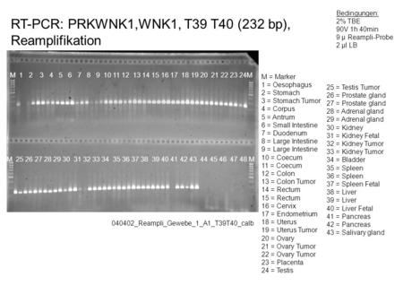 RT-PCR: PRKWNK1,WNK1, T39 T40 (232 bp), Reamplifikation 040402_Reampli_Gewebe_1_A1_T39T40_calb Bedingungen: 2% TBE 90V 1h 40min 9 µ Reampli-Probe 2 µl.