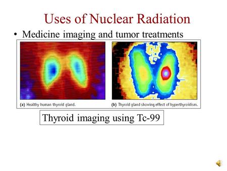 Medicine imaging and tumor treatments Thyroid imaging using Tc-99 Uses of Nuclear Radiation.