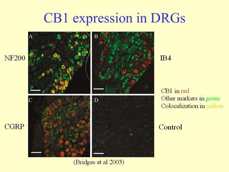 CB1 expression in DRGs. Pharmacological tools Selectivity and affinity of CB1 agonists are suboptimal (Pertwee 2009)