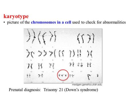 Karyotype picture of the chromosomes in a cell used to check for abnormalities Prenatal diagnosis: Trisomy 21 (Down’s syndrome)