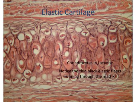 Elastic Cartilage Chondrocytes in Lacunae Notice the thin black elastic fibers running through the matrix.