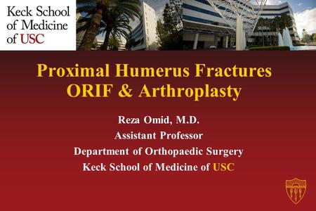 Proximal Humerus Fractures ORIF & Arthroplasty Reza Omid, M.D. Assistant Professor Department of Orthopaedic Surgery Keck School of Medicine of USC.