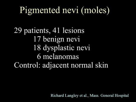 Pigmented nevi (moles) 29 patients, 41 lesions 17 benign nevi 18 dysplastic nevi 6 melanomas Control: adjacent normal skin Richard Langley et al., Mass.