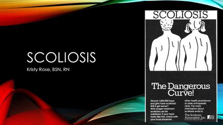 SCOLIOSIS Kristy Rose, BSN, RN.  s7452.html