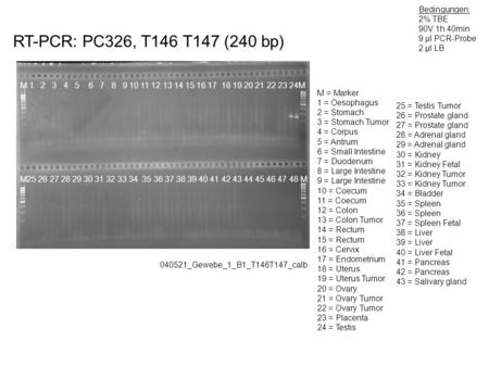 RT-PCR: PC326, T146 T147 (240 bp) 040521_Gewebe_1_B1_T146T147_calb Bedingungen: 2% TBE 90V 1h 40min 9 µl PCR-Probe 2 µl LB M 1 2 3 4 5 6 7 8 9 10 11 12.