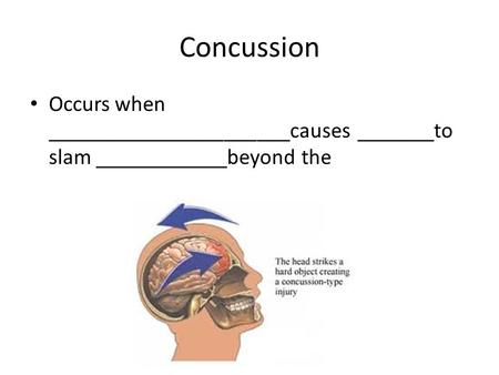 Concussion Occurs when ______________________causes _______to slam ____________beyond the.
