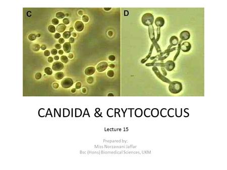 CANDIDA & CRYTOCOCCUS Prepared by: Miss Norzawani Jaffar Bsc (Hons) Biomedical Sciences, UKM Lecture 15.