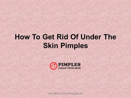 How To Get Rid Of Under The Skin Pimples For More Visit Pimples.io.