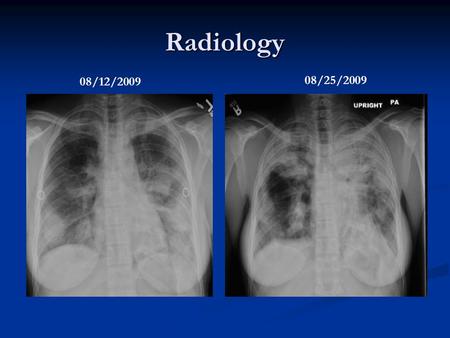 Radiology 08/12/2009 08/25/2009.