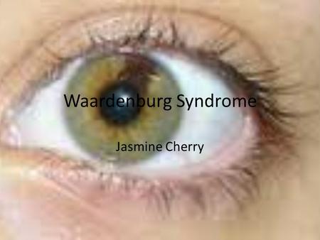 Waardenburg Syndrome Jasmine Cherry. What is it? Waardenburg syndrome is a group of changes within genes that can cause hearing loss and a change in hair,