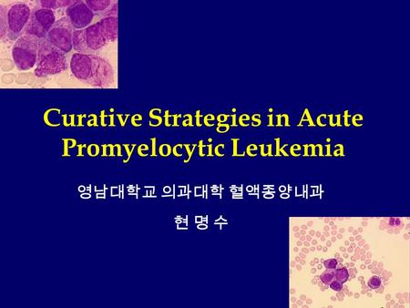 영남대학교 의과대학 혈액종양내과 현 명 수 Curative Strategies in Acute Promyelocytic Leukemia.