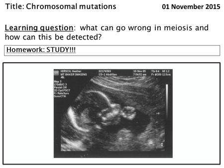 Title: Chromosomal mutations 01 November 2015 Learning question: what can go wrong in meiosis and how can this be detected? Homework: STUDY!!!