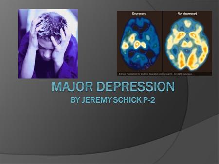Major Depression By Jeremy Schick p-2