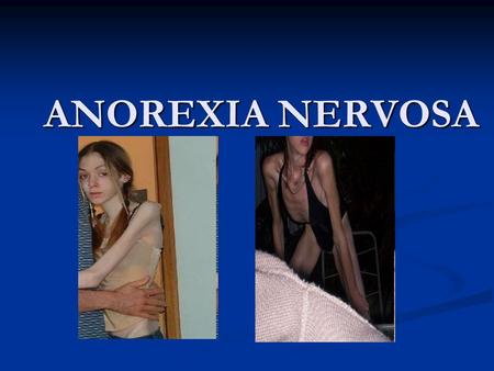 ANOREXIA NERVOSA. WHAT IS ANOREXIA NERVOSA? Anorexia nervosa is a psychiatric illness that describes an eating disorder characterized by extremely low.