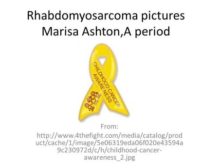 Rhabdomyosarcoma pictures Marisa Ashton,A period From:  uct/cache/1/image/5e06319eda06f020e43594a 9c230972d/c/h/childhood-cancer-