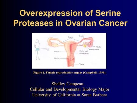 Overexpression of Serine Proteases in Ovarian Cancer Shelley Campeau Cellular and Developmental Biology Major University of California at Santa Barbara.