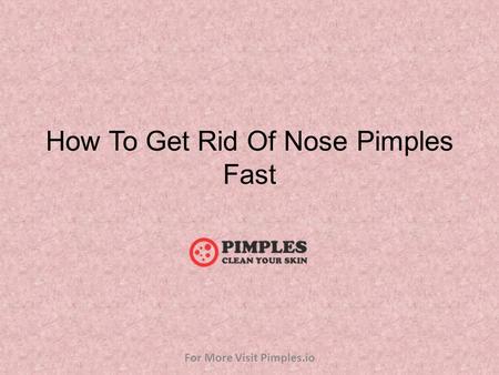 How To Get Rid Of Nose Pimples Fast For More Visit Pimples.io.
