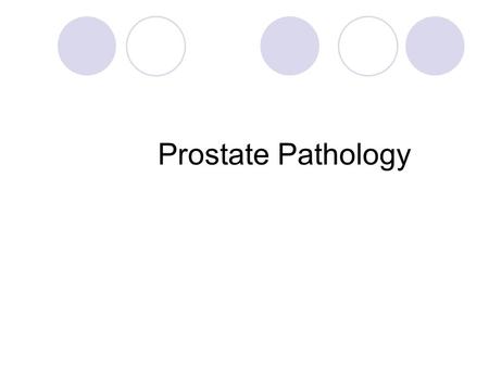 Prostate Pathology. Prostate weighs 20 grams in normal adult Retroperitoneal organ,encircling the neck of bladder and urethra Devoid of a distinct capsule.