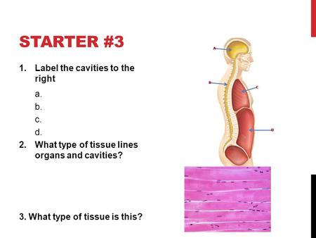 STARTER #3 1.Label the cavities to the right a. b. c. d. 2.What type of tissue lines organs and cavities? 3. What type of tissue is this?
