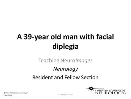 A 39-year old man with facial diplegia Teaching NeuroImages Neurology Resident and Fellow Section Campbell J, et al © 2013 American Academy of Neurology.