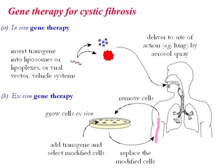 Gene therapy for cystic fibrosis. 1.The possibility of replacing a defective gene with a ‘good’ copy of the gene to overcome the problems caused by the.