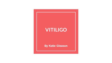 VITILIGO By Katie Gleason. What Is It? loss of pigment patches of discoloration equally affects all of the population Tracked through families Causes.
