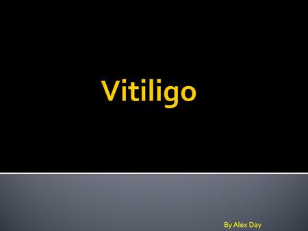Vitiligo By Alex Day.