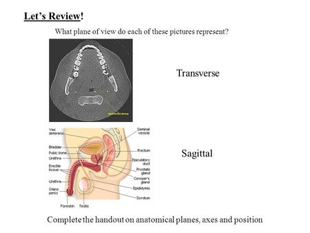 Complete the handout on anatomical planes, axes and position