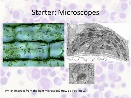 Starter: Microscopes Which image is from the light microsope? How do you know?