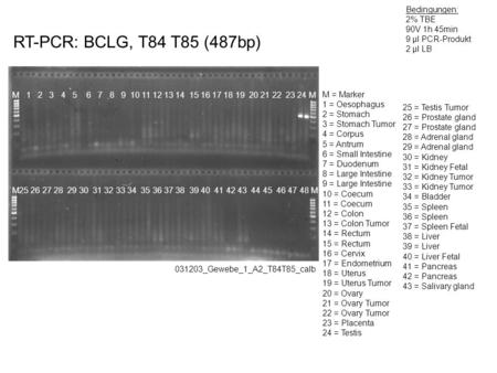 RT-PCR: BCLG, T84 T85 (487bp) 031203_Gewebe_1_A2_T84T85_calb Bedingungen: 2% TBE 90V 1h 45min 9 µl PCR-Produkt 2 µl LB M 1 2 3 4 5 6 7 8 9 10 11 12 13.