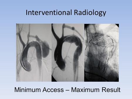 Interventional Radiology Minimum Access – Maximum Result.