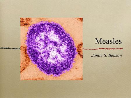 Measles Jamie S. Benson. Origins Originated in 165 AD in Europe First known as “The Antonine Plague,” and the “Plague of Galen.” First scientific distinction.