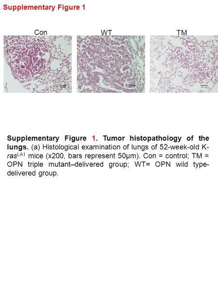 Con WTTM Supplementary Figure 1 Supplementary Figure 1. Tumor histopathology of the lungs. (a) Histological examination of lungs of 52-week-old K- ras.