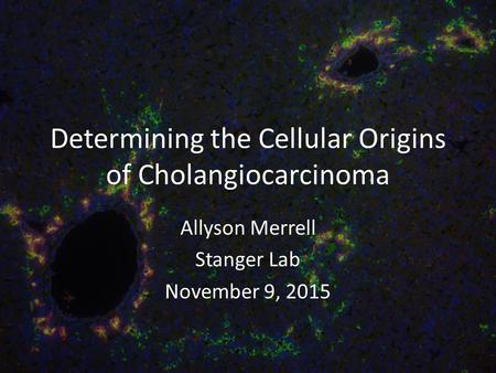 Determining the Cellular Origins of Cholangiocarcinoma