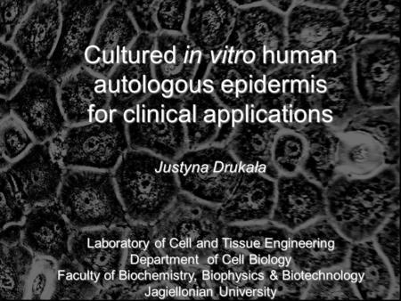 Cultured in vitro human autologous epidermis for clinical applications Justyna Drukała Laboratory of Cell and Tissue Engineering Department of Cell.