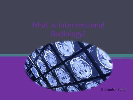 What is interventional Radiology? By: Amber Smith.