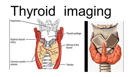 Thyroid imaging. Gamma camera ultrasound Non ionizing radiation Clear out the nature of a nodule,,weather cystic or solid Readily available method.