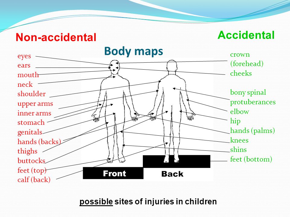 download ct scanner iq view 2 6 0