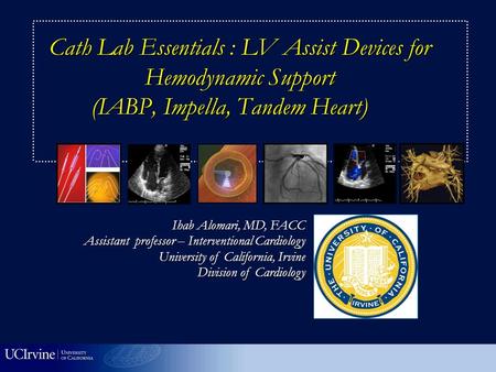 Ihab Alomari, MD, FACC Assistant professor – Interventional Cardiology University of California, Irvine Division of Cardiology Cath Lab Essentials : LV.
