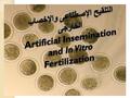 Lecture Contents 1- History of artificial insemination 2- Types of artificial insemination 3- Artificial insemination in farm and laboratory animals 4-