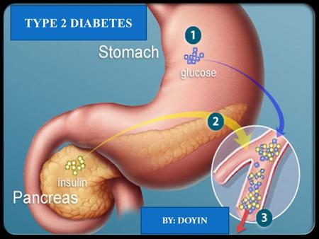 TYPE 2 DIABETES BY: DOYIN. How to regulate the amount of glucose in the pancreas by Creating a new food Pyramid Diabetes is the lack of enough insulin.